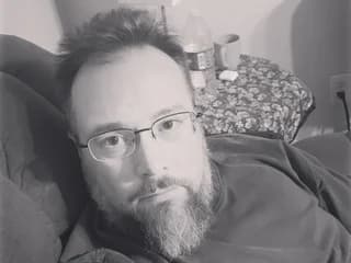 WebCAM di Allergictocam